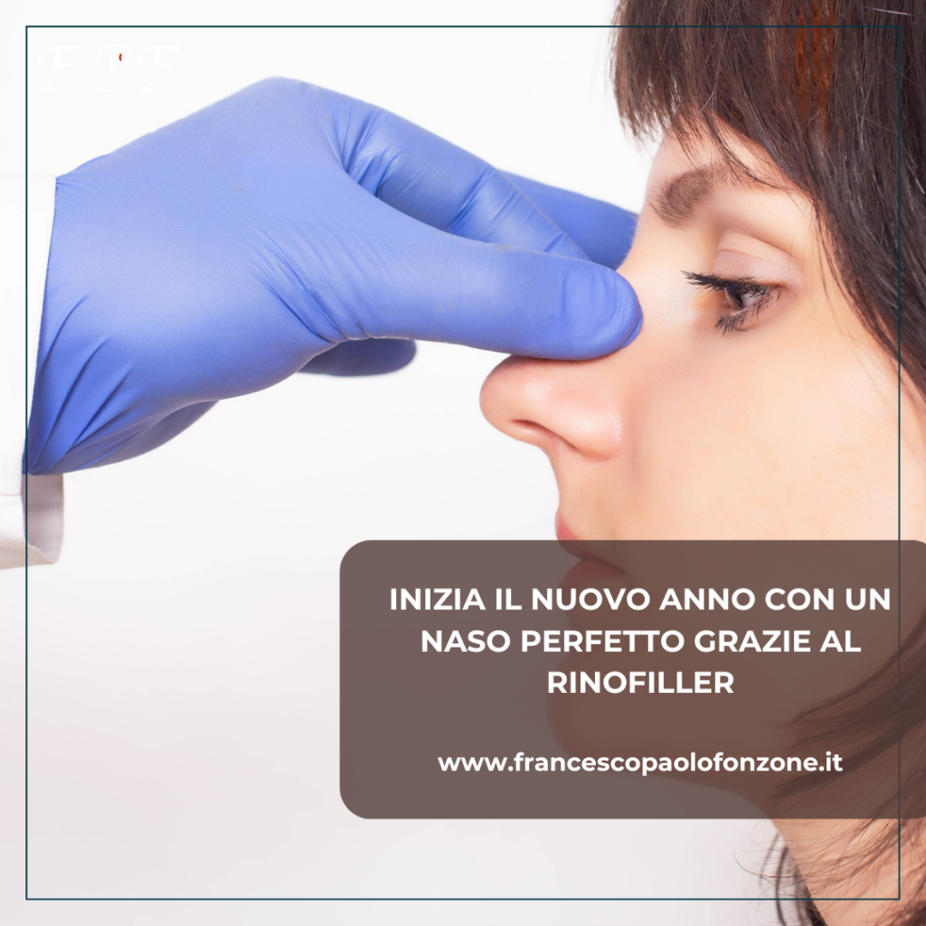 Creativita Fonzone Blog x - rinoplastica - Chirurgo Plastico Napoli